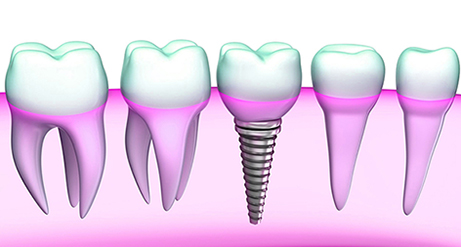 Cirugía Oral y Maxilofacial